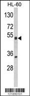 Nuclear Receptor Subfamily 1 Group I Member 2 antibody, 63-583, ProSci, Western Blot image 