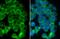Desmoglein 2 antibody, GTX102508, GeneTex, Immunofluorescence image 
