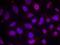 Myocyte Enhancer Factor 2A antibody, GTX50114, GeneTex, Immunofluorescence image 