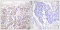 TNF Receptor Superfamily Member 1A antibody, abx013235, Abbexa, Western Blot image 