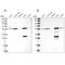 Aldehyde Dehydrogenase 6 Family Member A1 antibody, NBP1-82635, Novus Biologicals, Western Blot image 