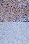 Phosphatase And Tensin Homolog antibody, MAB847, R&D Systems, Immunohistochemistry frozen image 