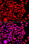 Testis Associated Actin Remodelling Kinase 2 antibody, STJ29596, St John