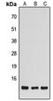 NADH:Ubiquinone Oxidoreductase Subunit S5 antibody, LS-C368435, Lifespan Biosciences, Western Blot image 