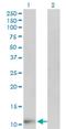 Fatty Acid Binding Protein 6 antibody, H00002172-M01, Novus Biologicals, Western Blot image 