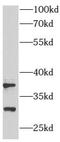 Armadillo Repeat Containing 10 antibody, FNab00583, FineTest, Western Blot image 