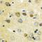 Mitogen-Activated Protein Kinase Kinase Kinase 7 antibody, orb315801, Biorbyt, Immunohistochemistry paraffin image 