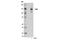 Tyrosine Kinase 2 antibody, 14193S, Cell Signaling Technology, Western Blot image 