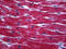 Troponin T2, Cardiac Type antibody, 51-649, ProSci, Immunohistochemistry paraffin image 