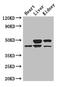 TGFB Induced Factor Homeobox 1 antibody, CSB-PA623005LA01HU, Cusabio, Western Blot image 