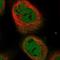 Stearoyl-CoA Desaturase 5 antibody, NBP1-89274, Novus Biologicals, Immunocytochemistry image 