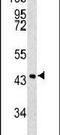 Serpin Family B Member 3 antibody, PA5-13522, Invitrogen Antibodies, Western Blot image 