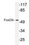 Forkhead Box O4 antibody, AP20362PU-N, Origene, Western Blot image 