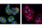 c-met antibody, 8494S, Cell Signaling Technology, Immunocytochemistry image 