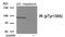 Insulin Receptor antibody, 79-989, ProSci, Western Blot image 