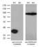 Galectin 3 antibody, LS-C793885, Lifespan Biosciences, Western Blot image 