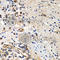 Minichromosome Maintenance Complex Component 2 antibody, A1056, ABclonal Technology, Immunohistochemistry paraffin image 