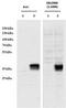 Coiled-Coil Domain Containing 3 antibody, MBS423049, MyBioSource, Western Blot image 
