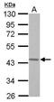 G Protein Subunit Alpha 15 antibody, GTX118385, GeneTex, Western Blot image 