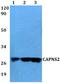 Calpain Small Subunit 2 antibody, A15186, Boster Biological Technology, Western Blot image 
