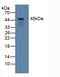 Serpin Family B Member 3 antibody, MBS2028258, MyBioSource, Western Blot image 