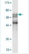 Small RNA Binding Exonuclease Protection Factor La antibody, H00006741-M02, Novus Biologicals, Western Blot image 