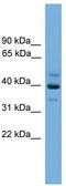 BCL2 Interacting Protein Like antibody, TA340278, Origene, Western Blot image 