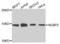 Nuclear Cap Binding Protein Subunit 2 antibody, LS-C346336, Lifespan Biosciences, Western Blot image 