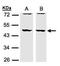 Drebrin Like antibody, PA5-28400, Invitrogen Antibodies, Western Blot image 