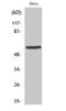 GM2/GD2 synthase antibody, A07778-1, Boster Biological Technology, Western Blot image 