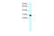 Single Stranded DNA Binding Protein 2 antibody, 27-407, ProSci, Western Blot image 