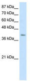 Era Like 12S Mitochondrial RRNA Chaperone 1 antibody, TA345927, Origene, Western Blot image 