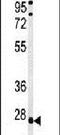 Tumor Protein P63 Regulated 1 Like antibody, PA5-25005, Invitrogen Antibodies, Western Blot image 