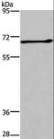 Activated Leukocyte Cell Adhesion Molecule antibody, LS-C402676, Lifespan Biosciences, Western Blot image 