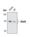 Signal Transducer And Activator Of Transcription 4 antibody, MA5-14976, Invitrogen Antibodies, Western Blot image 