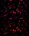 Insulin Like Growth Factor Binding Protein 4 antibody, GTX55672, GeneTex, Immunofluorescence image 