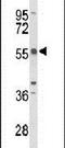 Tandem C2 Domains, Nuclear antibody, PA5-26433, Invitrogen Antibodies, Western Blot image 