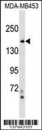 Tonsoku Like, DNA Repair Protein antibody, 59-419, ProSci, Western Blot image 