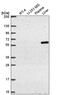 TERF1 Interacting Nuclear Factor 2 antibody, PA5-67076, Invitrogen Antibodies, Western Blot image 