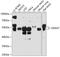 DEAD-Box Helicase 47 antibody, GTX64931, GeneTex, Western Blot image 