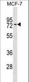 G Protein Nucleolar 1 (Putative) antibody, LS-C159748, Lifespan Biosciences, Western Blot image 