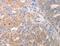 Keratin 6A antibody, MBS2517648, MyBioSource, Immunohistochemistry paraffin image 