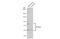 Transcription Factor 7 Like 2 antibody, GTX116056, GeneTex, Western Blot image 