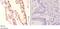 NADH dehydrogenase [ubiquinone] 1 alpha subcomplex subunit 8 antibody, A10547-1, Boster Biological Technology, Immunohistochemistry paraffin image 