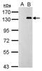 Toll Like Receptor 9 antibody, GTX100726, GeneTex, Western Blot image 