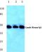 Casein Kinase 1 Gamma 1 antibody, A06904-1, Boster Biological Technology, Western Blot image 