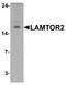 Late Endosomal/Lysosomal Adaptor, MAPK And MTOR Activator 2 antibody, A05508, Boster Biological Technology, Western Blot image 