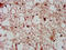 Cyclin Dependent Kinase 11A antibody, LS-C211746, Lifespan Biosciences, Immunohistochemistry paraffin image 