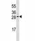 Erythropoietin antibody, F53667-0.1ML, NSJ Bioreagents, Western Blot image 