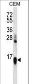 Histone Cluster 1 H2A Family Member A antibody, LS-C203663, Lifespan Biosciences, Western Blot image 